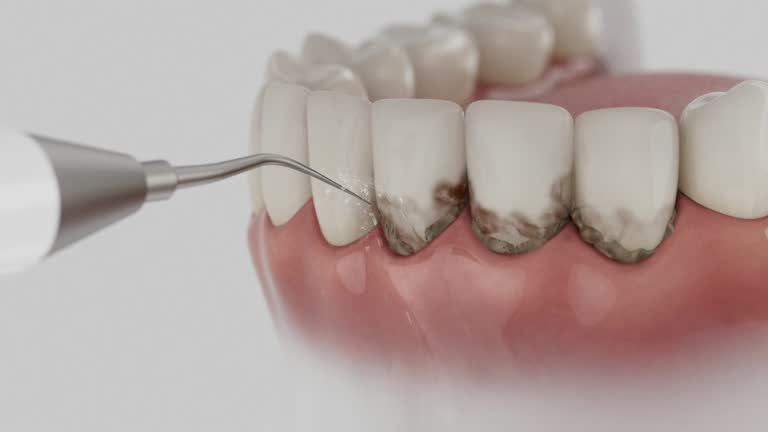 Reliable Wisdom Tooth Removal contractor in Clay County County, TN by Dentist Open Now